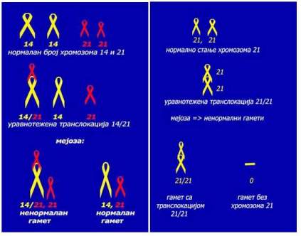 Uravnotežena translokacija