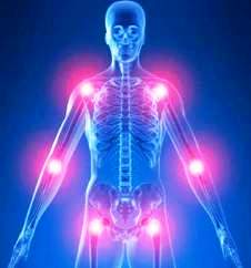 Najcesce lokalizacije reumatoidnog artritisa